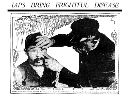 「ジャップが恐ろしい伝染病を運んでくる」と題したサンフランシスコクロニクルの記事（1945年４月２日号） カリフォルニア州、サンフランシスコ Courtesy of the San Francisco Chronicle 